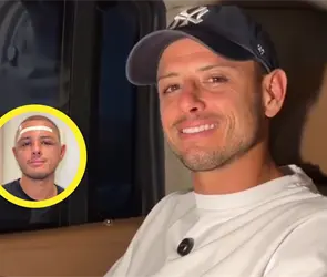 &iexcl;Qu&eacute; cambio! Chicharito muestra su cara tras operaci&oacute;n
