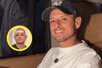 ¡Qué cambio! Chicharito muestra su cara tras operación ¡Qué cambio! Chicharito muestra su cara tras operación