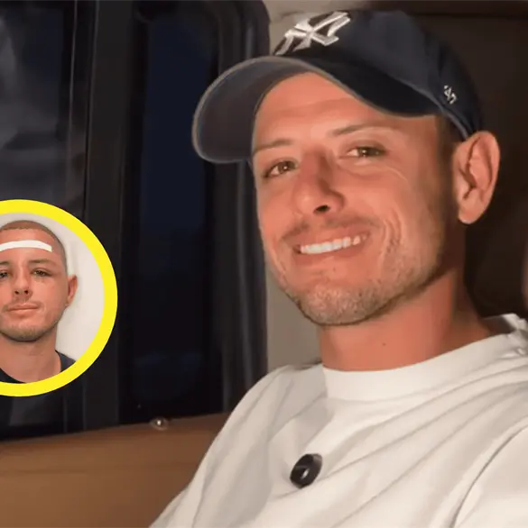 ¡Qué cambio! Chicharito muestra su cara tras operación ¡Qué cambio! Chicharito muestra su cara tras operación